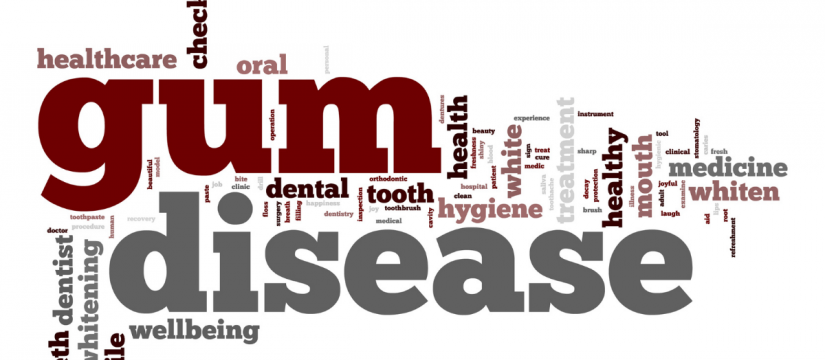 Gum Disease Treatment Miami